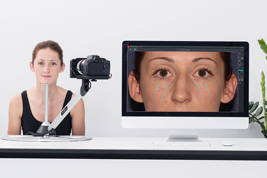 FotoFinder ứng dụng xuất sắc trong thẩm mỹ. FotoFinder ứng dụng xuất sắc trong thẩm mỹ.